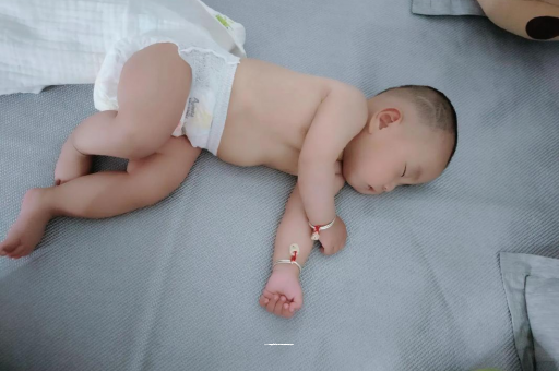 成都宝宝头上长痱子